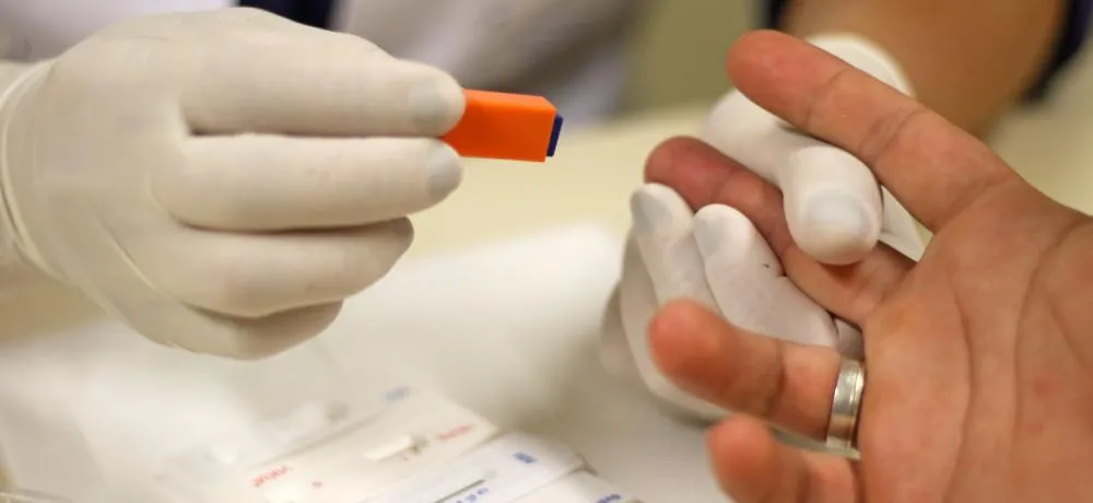 Sesab desmente boato de surto de HIV na Bahia 