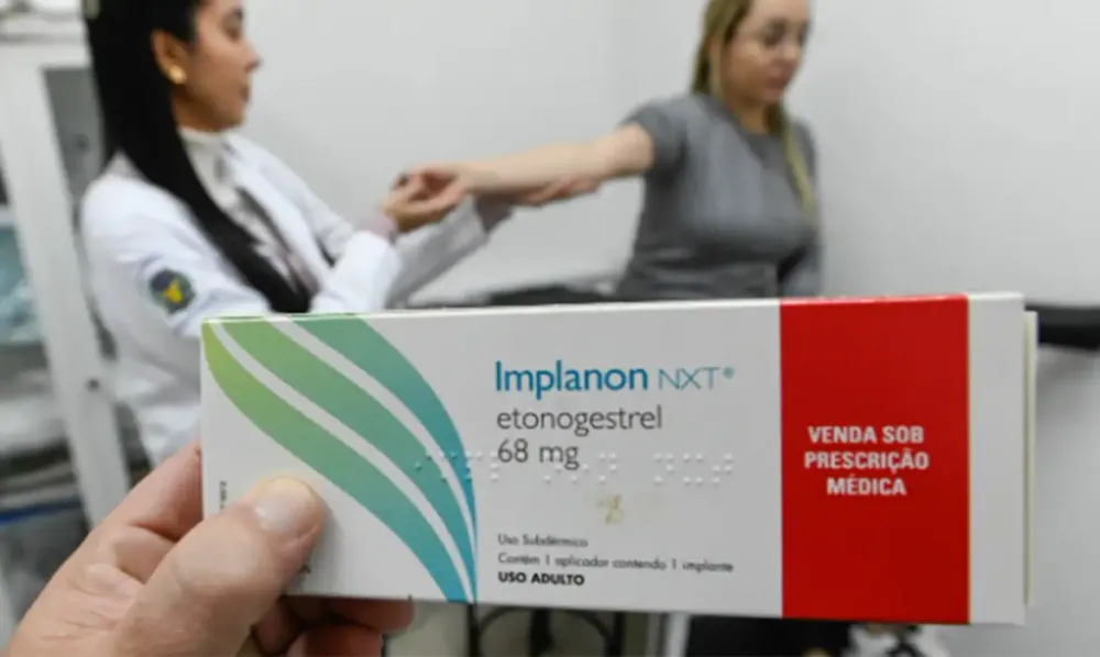 Implante contraceptivo deve ser ofertado por planos a partir desta segunda-feira (1º)