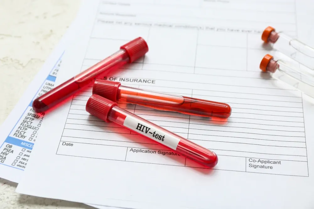 Brasil registra cerca de 40 mil novos casos de HIV por ano, alerta campanha do Dezembro Vermelho
