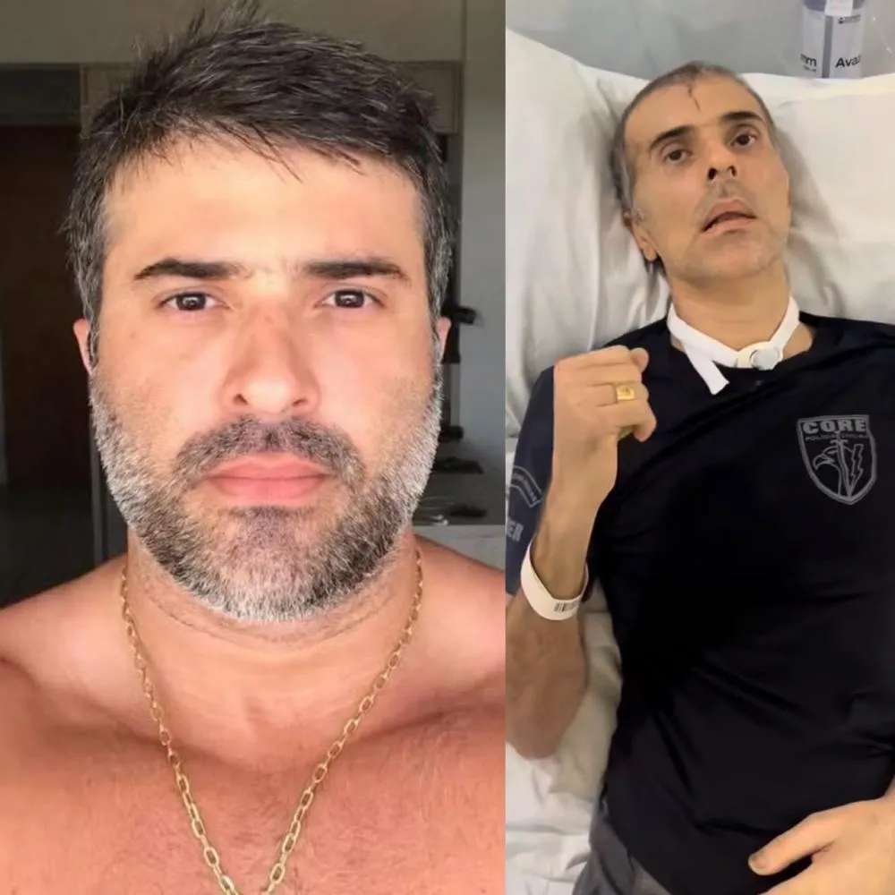 Policial baleado em operação no Rio tem complicações após cirurgia craniana